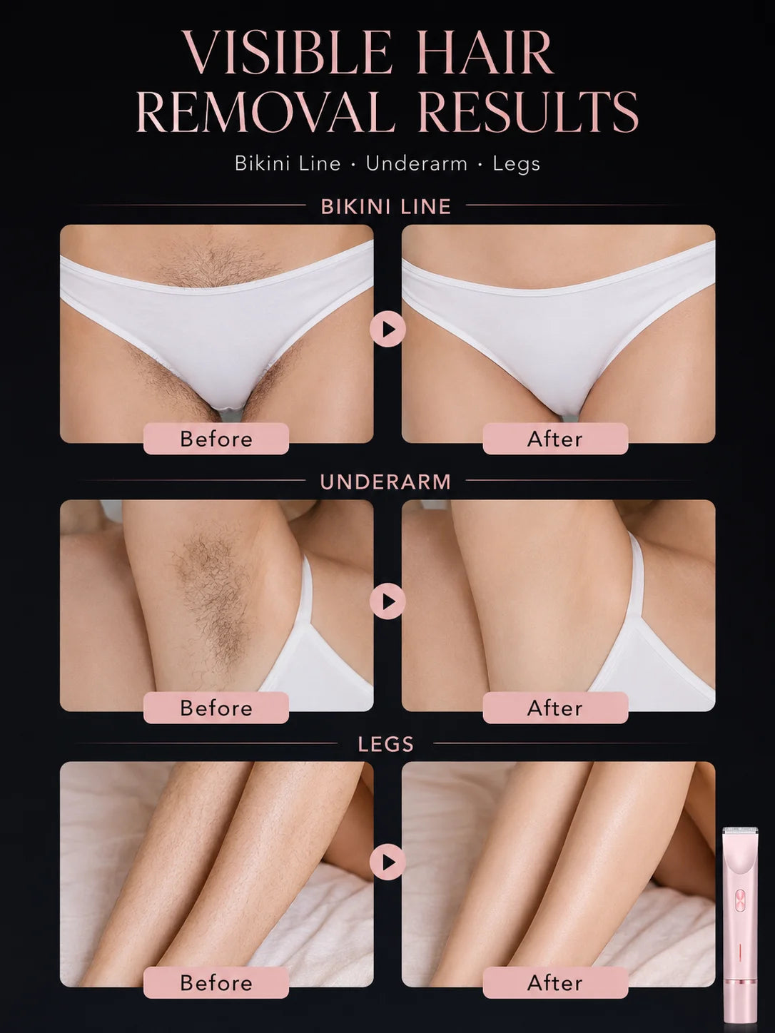 Women Electric Shaver Double Head Female Razor Body Hair Remover Epilator Leg Underarm Bikini Trimmer Rechargeable Portable